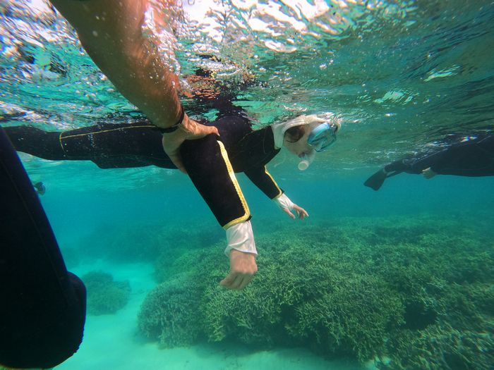 足首の骨折は大丈夫です！